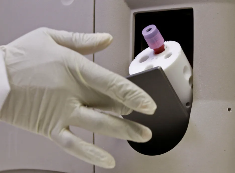Testování krve na virus HIV