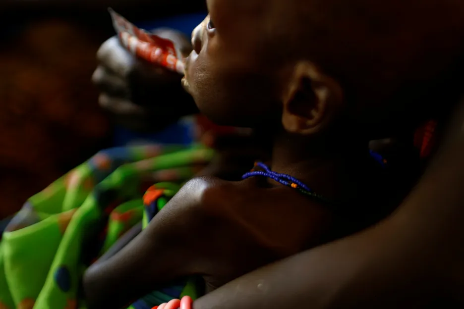 Podvyživené dítě v Jižním Súdánu