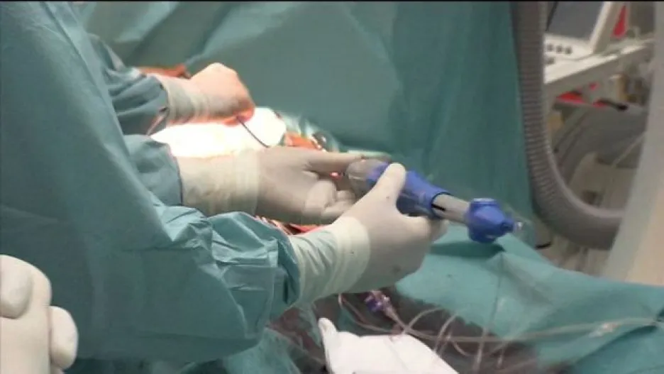 Video Implantace chlopně nové generace poprvé v Podlesí