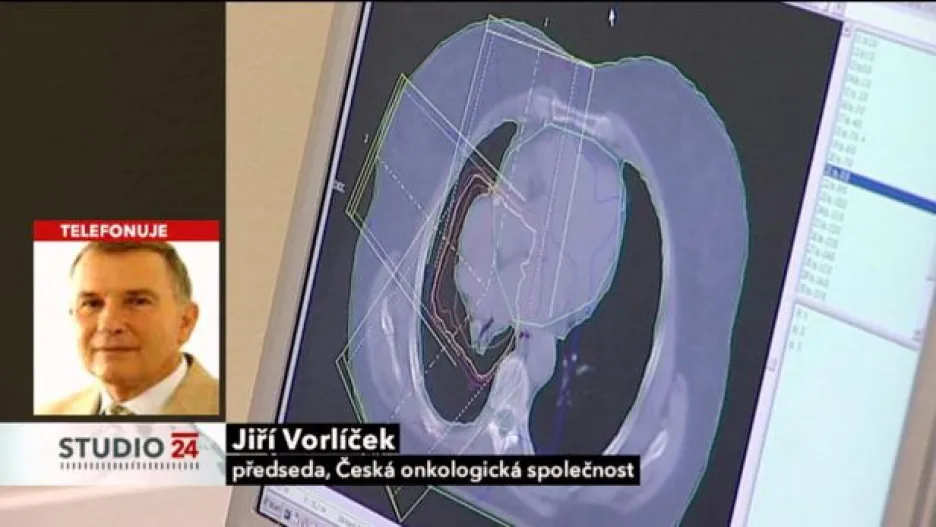 Video Rozhovor s předsedou České onkologické společnosti