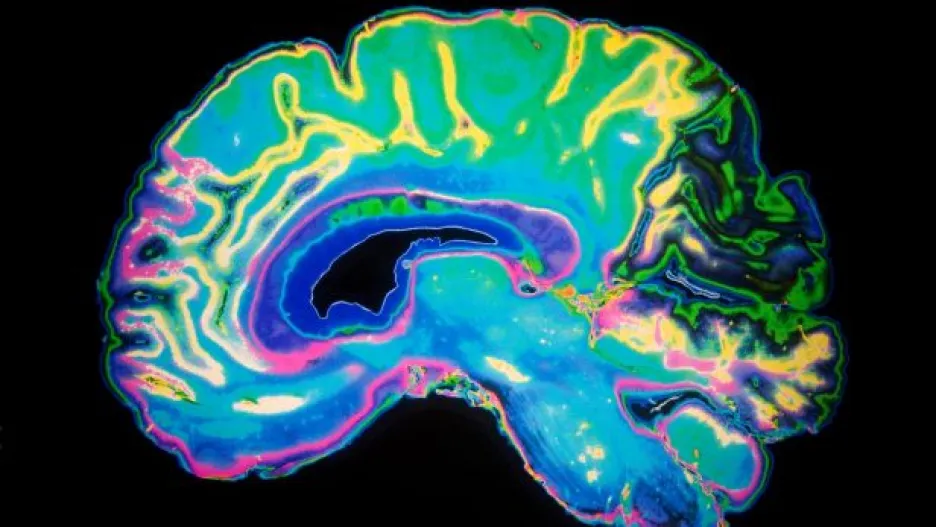 Video Vědec Syka: Mozek je nejsložitější organizovaná hmota ve vesmíru