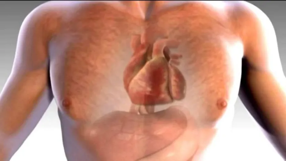 Video Kardiolog: Výskyt srdečních vad v populaci je 7 na 1000