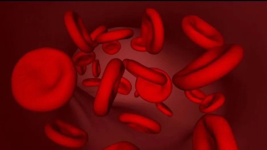 Video UDÁLOSTI: Čeští vědci objevili nové onemocnění krve