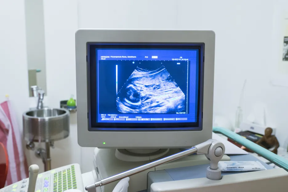 Ilustrační fotografie: Monitoring dítěte ultrazvukem