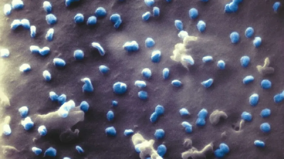 Virus SARS-CoV-2 (modře) pod mikroskopem: 