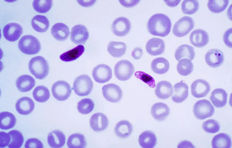 Plasmodium falciparum, původce malárie