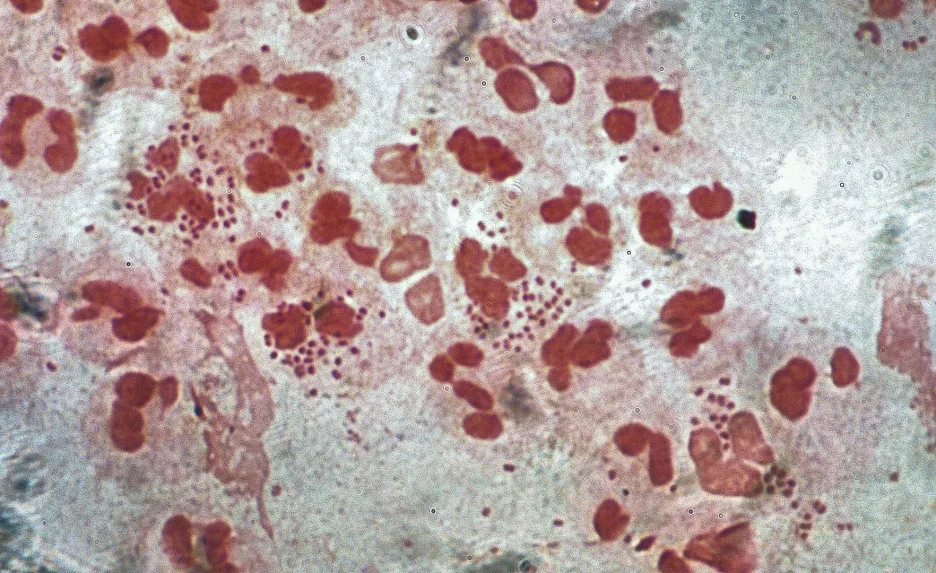 Bakterie Neisseria gonorrhoeae