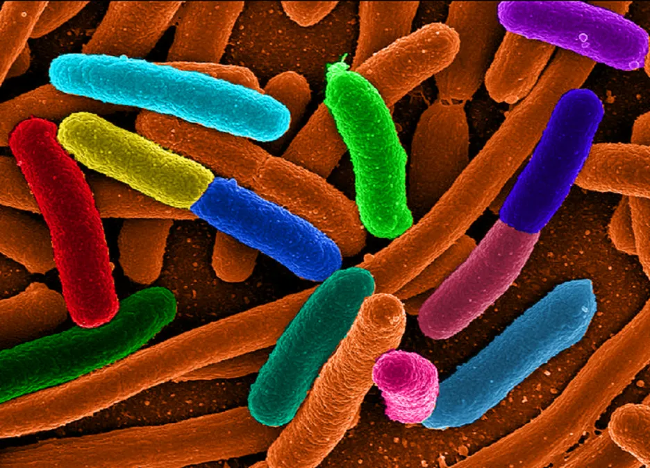 Bakterie e.coli