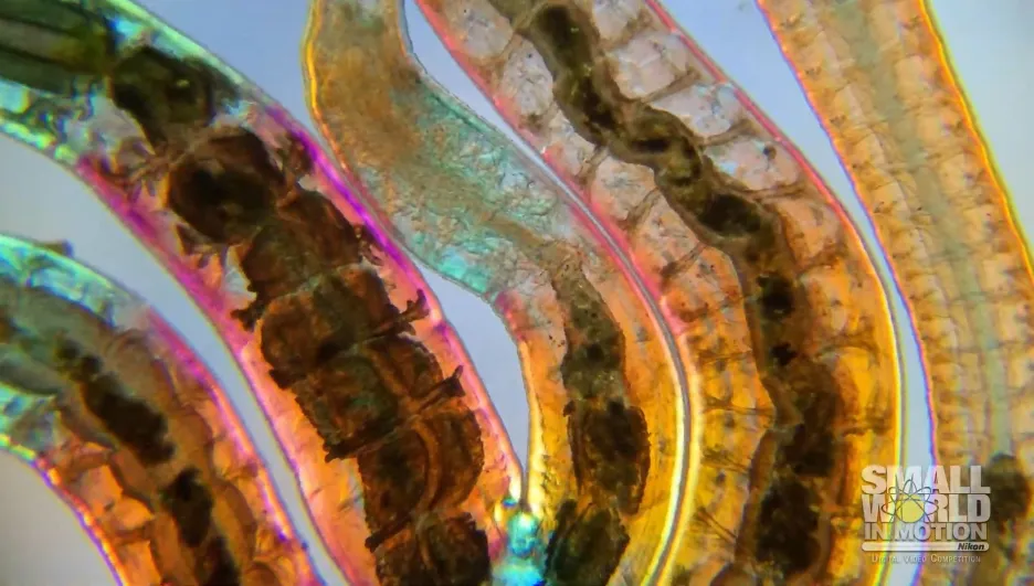 Peristaltika žížalice pestré pod mikroskopem