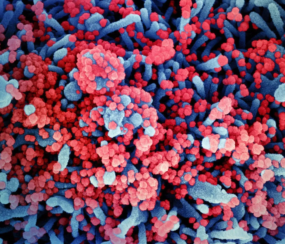 Kolorovaný snímek viru SARS-CoV-2 (červeně) napadajícího buňky (modře)