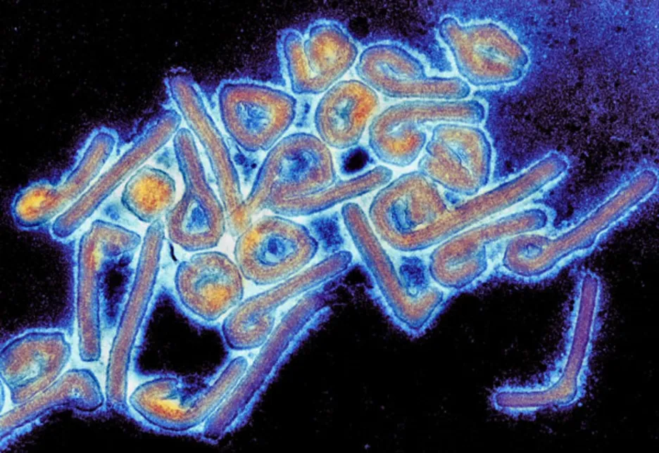 Virus marburg pod elektronovým mikroskopem, kolorizováno
