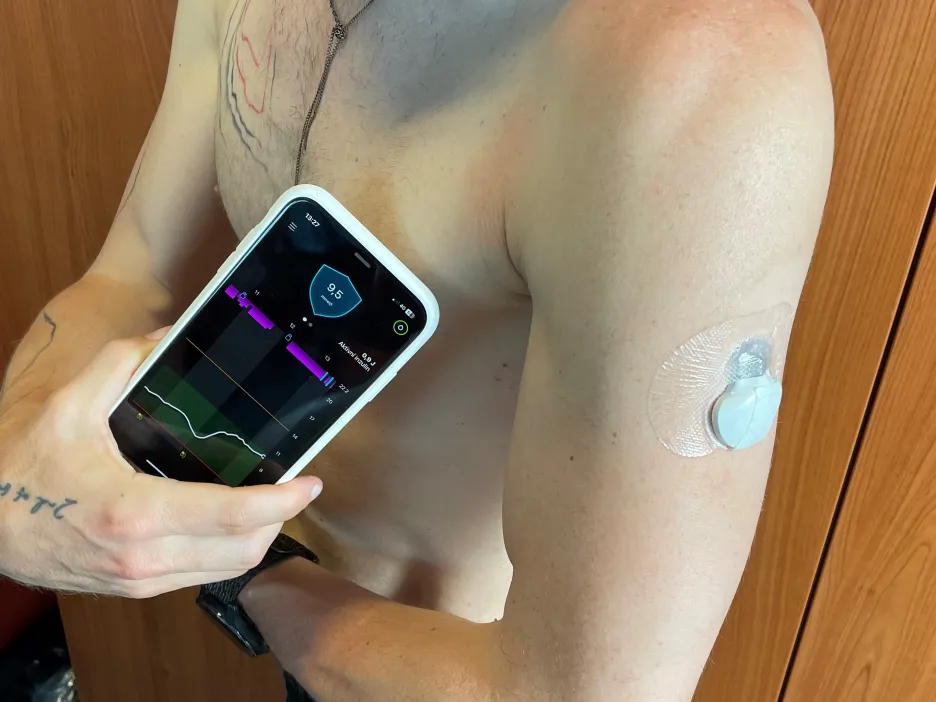 Senzor s naměřenými hladinami glukózy v krvi v mobilní aplikaci