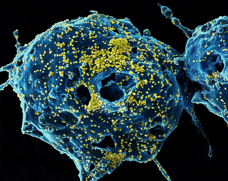 Částice viru MERS-cov (žlutě) na buňce (modrá)