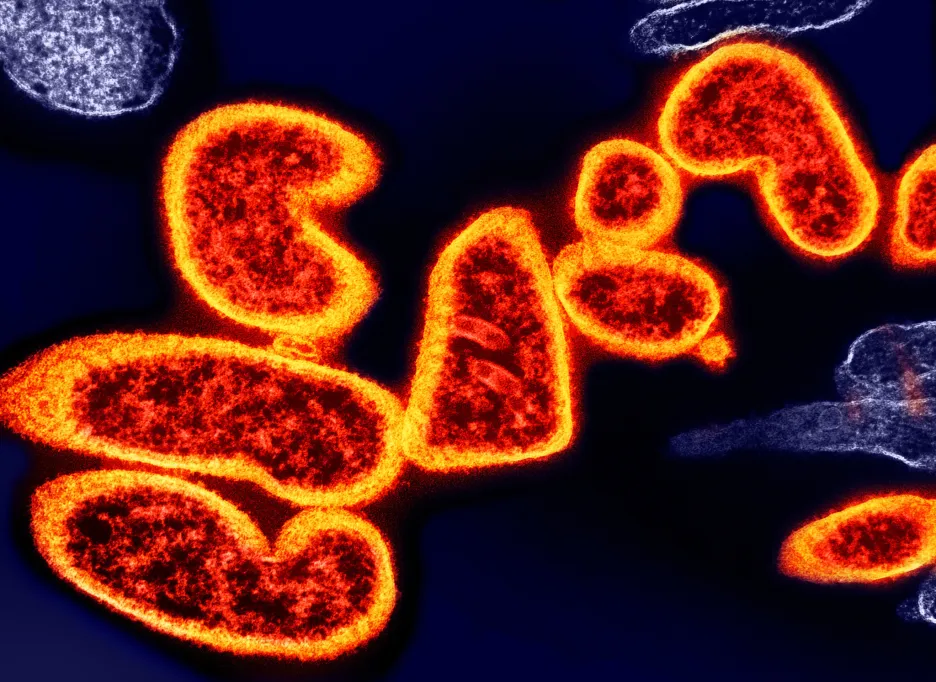 Kolorovaný snímek viru nipah