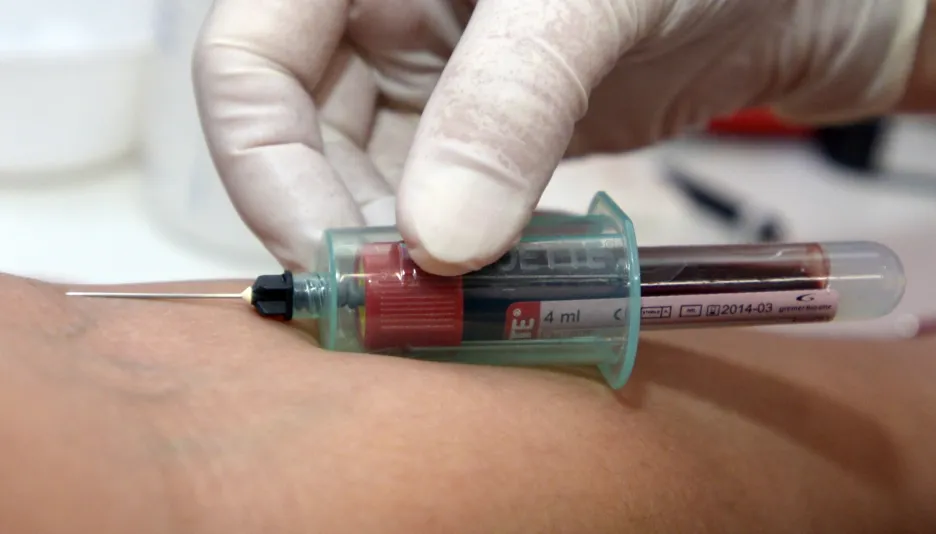 Testování na HIV