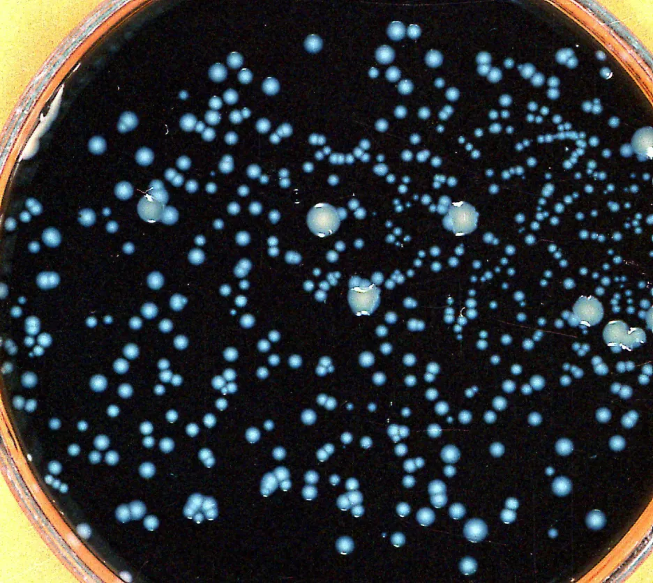 Bakterie způsobuje Pontiackou horečku i Legionářskou nemoc