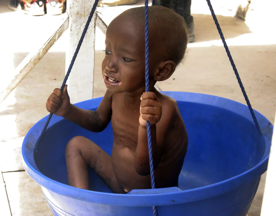 Podvyživené somálské dítě - snímek z roku 2011