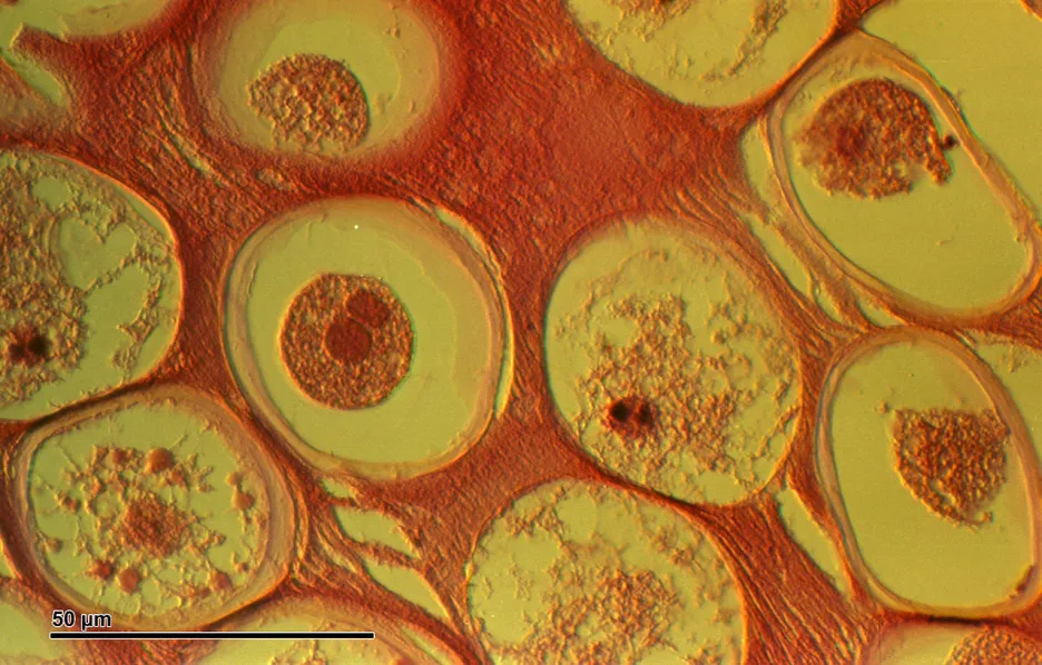 Škrkavka dětská pod mikroskopem