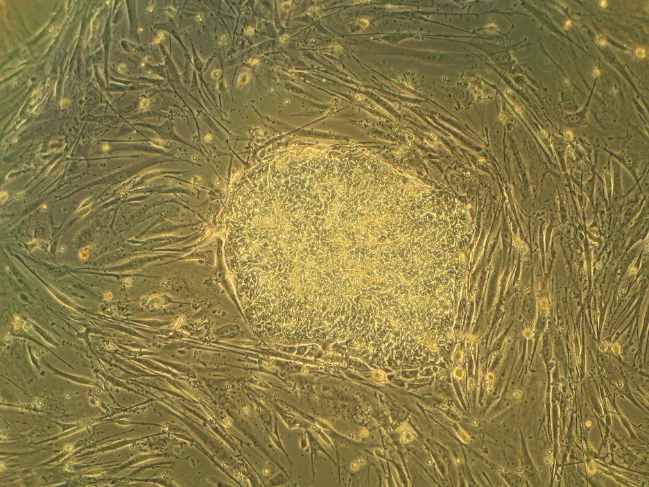 Kolonie lidských embryonálních kmenových buněk