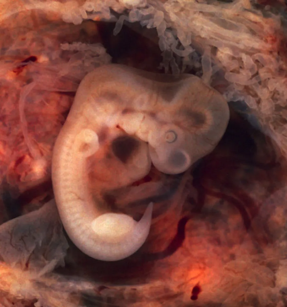 Lidské embryo