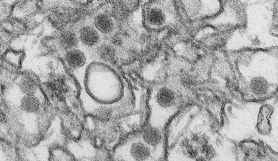 Detailní snímek viru Zika