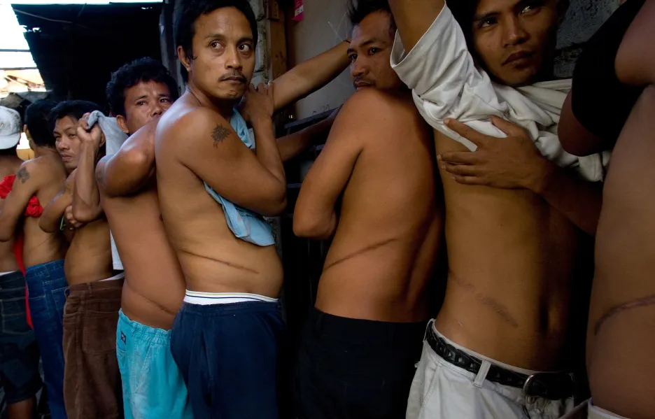 Richard Jones / Z cyklu Filipínský obchod s orgány, 2007