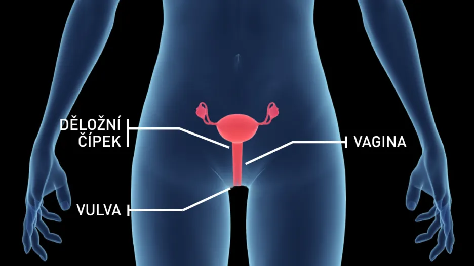 Vliv HPV na ženu