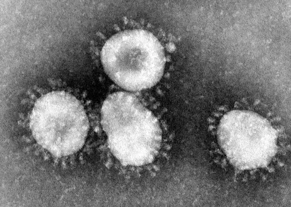 Koronavirus SARS