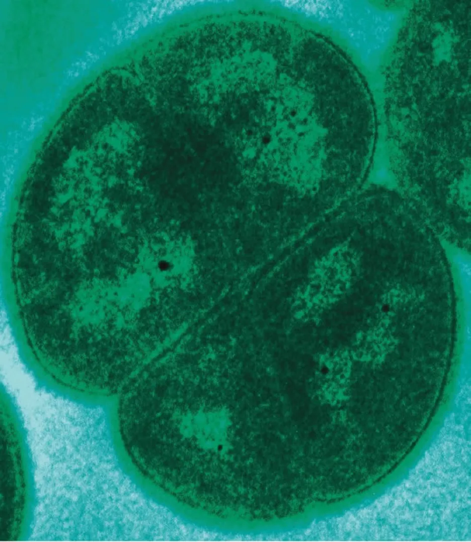 Bakterie Deinococcus radiodurans pod mikroskopem