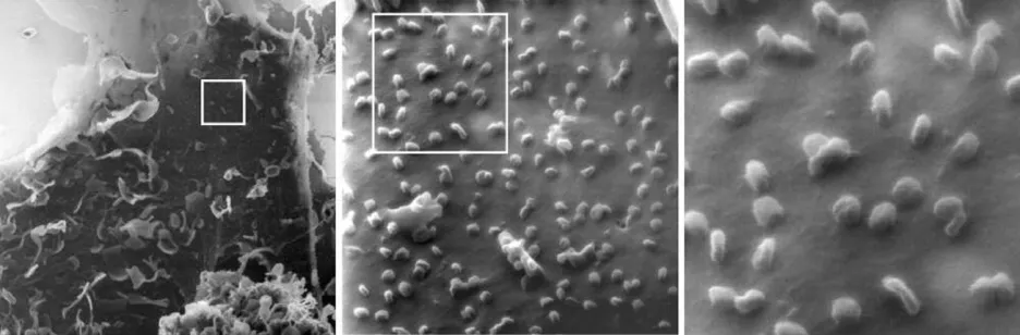 SARS-CoV-2 pod mikroskopem útočící na buňky ledvin