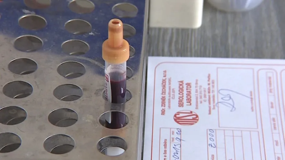 Laboratoř v Bratislavské ulici jako jediná testovala krev na HIV bezplatně