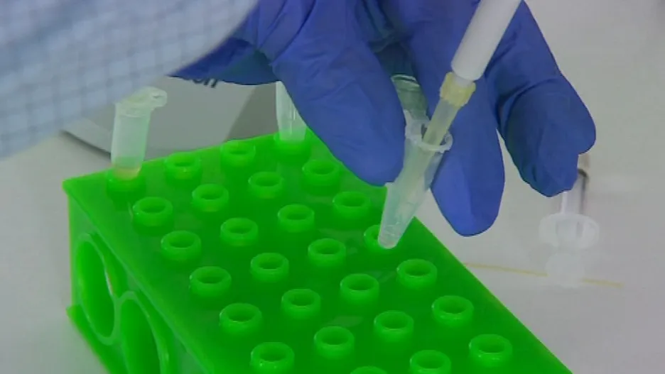 Testování hladiny kyseliny mravenčí ve vzorku krve