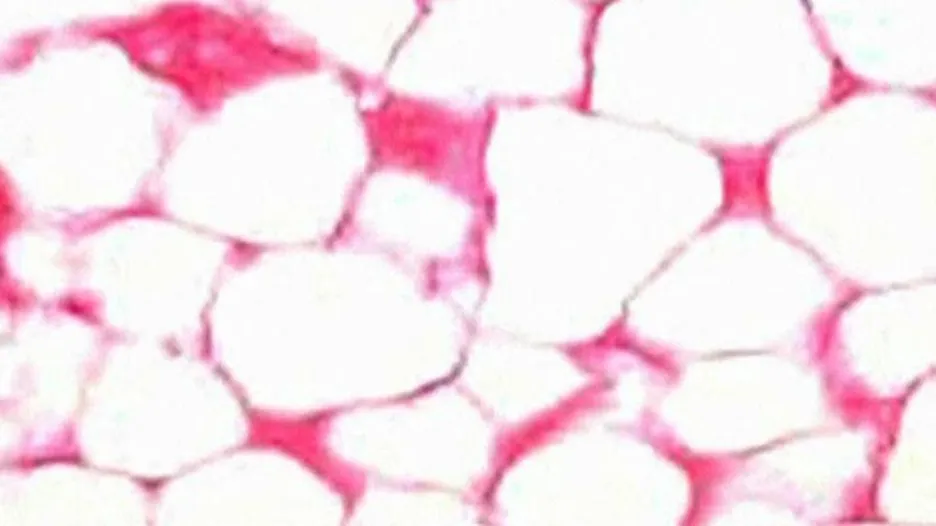 Bílé tukové buňky