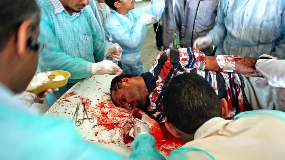 Oběť nepokojů v Jemenu