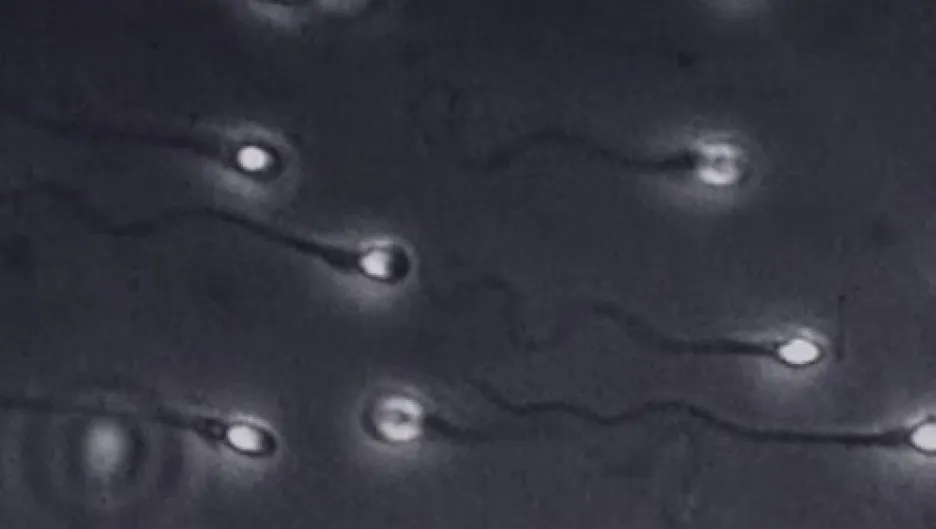 Spermie pod mikroskopem