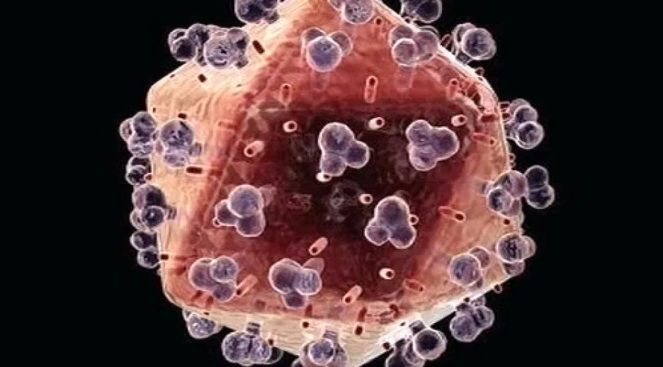 Buňka napadená virem HIV