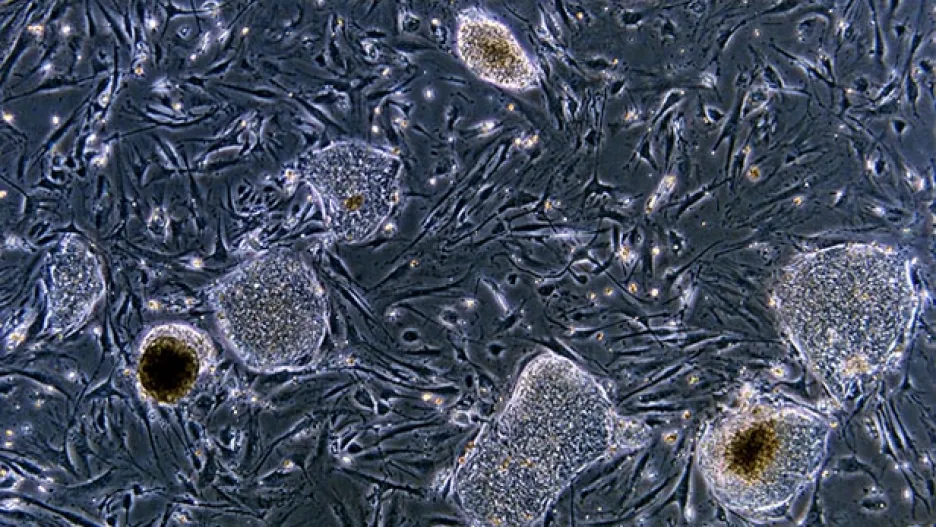 Embryonální kmenové buňky