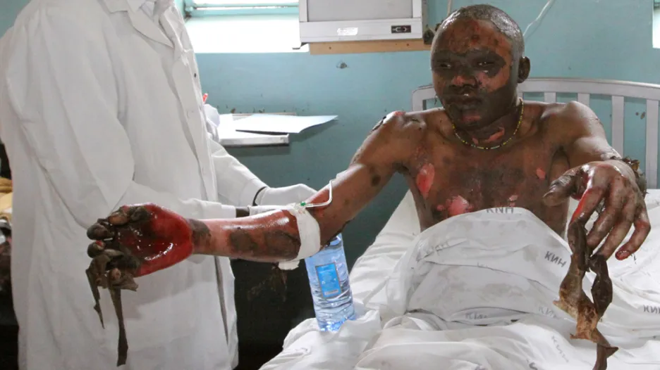 Muž popálený při výbuchu ropovodu v Nairobi