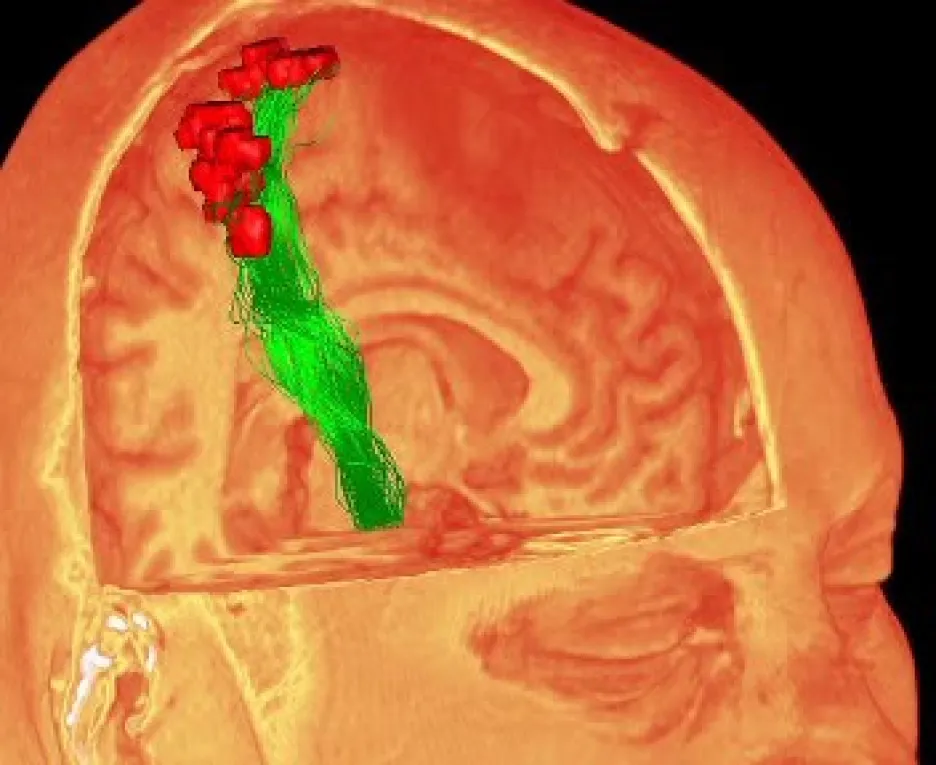 Trojrozměrný obraz mozku