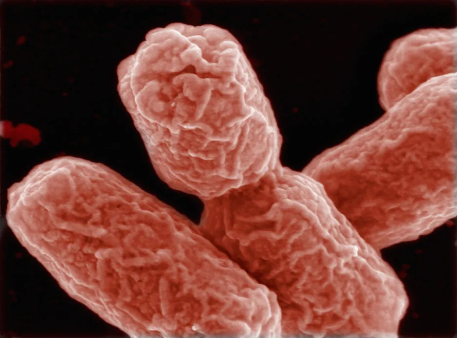 Enterohemoragická Escherichia coli