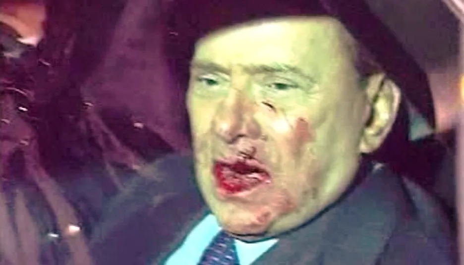 Zraněný Silvio Berlusconi