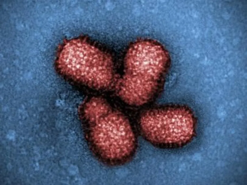 Virus chřipky typu H1N1