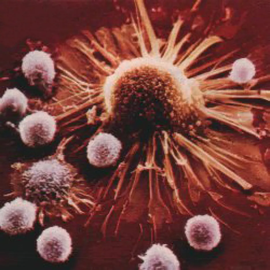 Rakovinná buňka napadená imunitním systémem