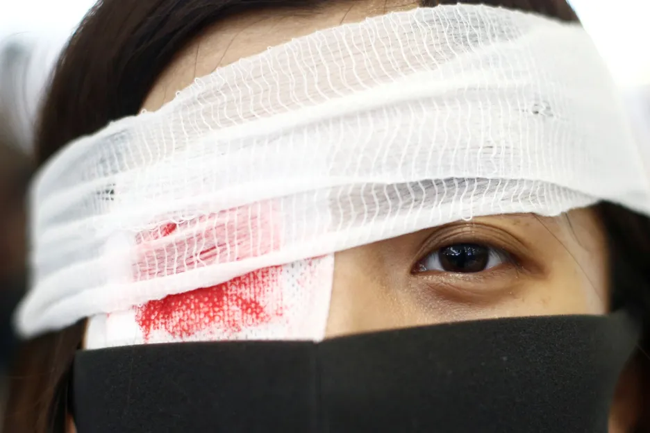 Demonstranti si na protest proti zranění medičky gumovým projektilem zakrývají oko páskou s falešnou krví