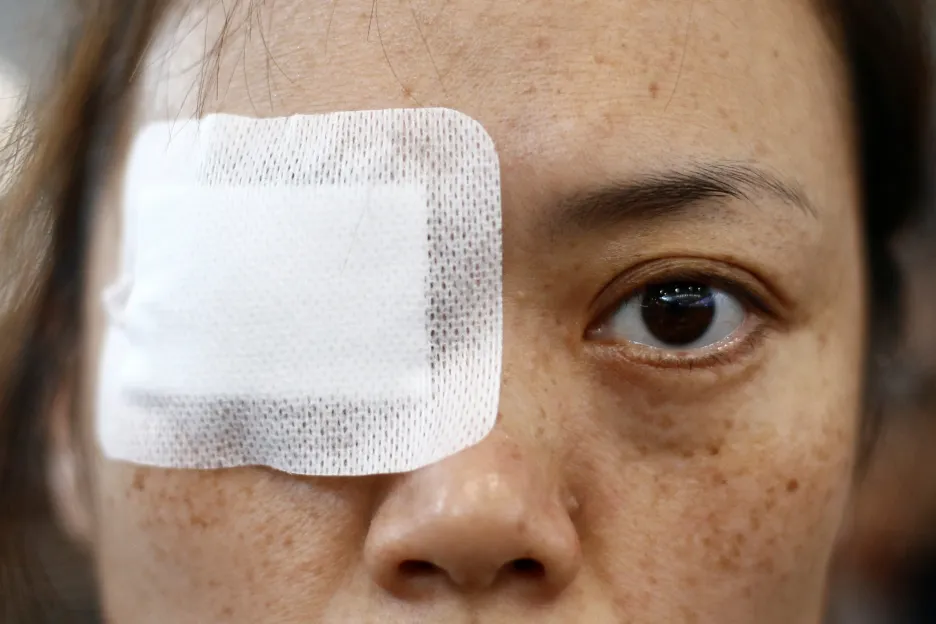 Demonstranti si na protest proti zranění medičky gumovým projektilem zakrývají oko páskou s falešnou krví